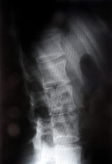 Image showing X-ray