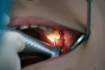 Image showing Dentist at work