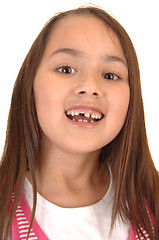 Image showing Girl loosing her teeth.