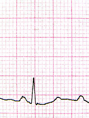 Image showing Real EKG - macro of a real electrocardiograph