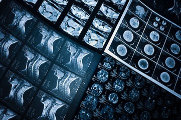 Image showing Several CT computer tomography scan images of neck and brain