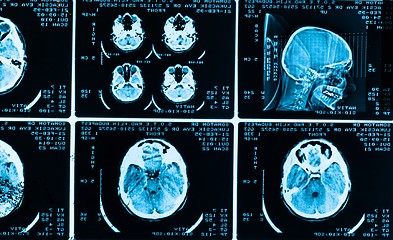 Image showing many type of brain scans with dark background