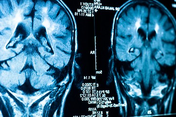 Image showing Closeup of a CT scan with brain