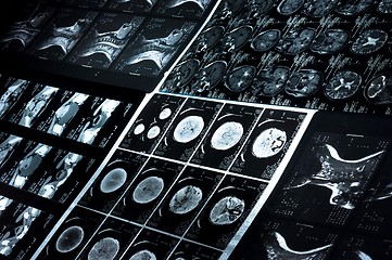 Image showing Several CT computer tomography scan images of neck and brain