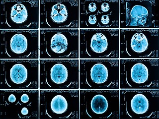 Image showing Scans of the brain