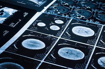 Image showing Several CT computer tomography scan images of the brain