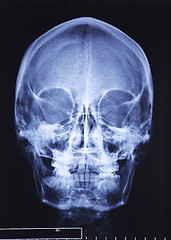 Image showing skull xray
