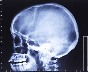 Image showing skull xray