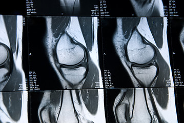 Image showing mri knee