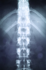 Image showing X-ray