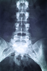 Image showing X-ray