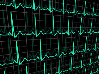 Image showing ECG tracing monitor. EPS 8