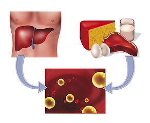 Image showing cholesterol in food