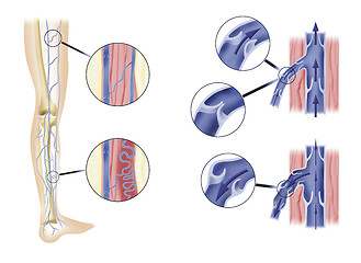 Image showing leg artery and aortic valves