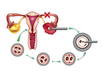 Image showing artificial insemination