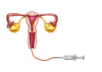 Image showing artificial insemination