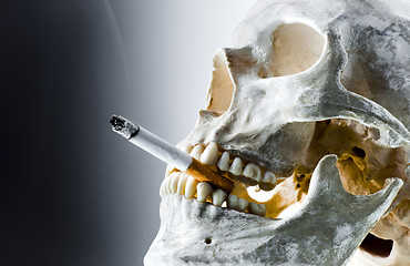 Image showing Skull with burning cigarette in mouth