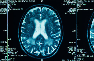 Image showing sharp ct scan of the human brain