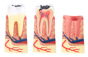 Image showing Tooth anatomy