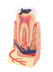 Image showing Tooth anatomy