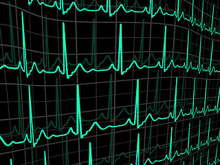 Image showing Heartbeat on a black monitor. EPS 8