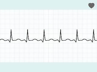 Image showing Normal electrocardiogram ECG. EPS 8