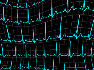 Image showing ECG tracing monitor. EPS 8