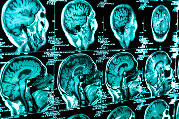 Image showing Ct scan of the human brain tile