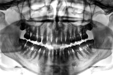 Image showing dental scan x-ray