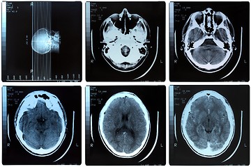 Image showing Medical Xray