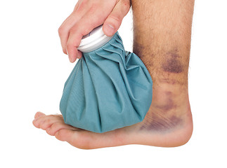Image showing Icing a sprained ankle
