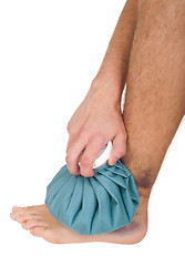 Image showing Icing a sprained ankle