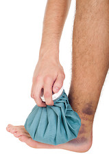 Image showing Icing a sprained ankle