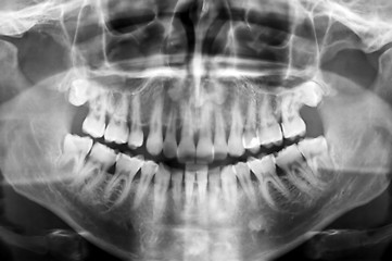 Image showing dental scan