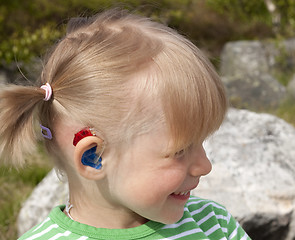 Image showing Smiling child with hearing aid