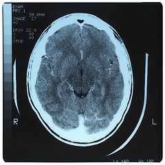 Image showing Medical Xray