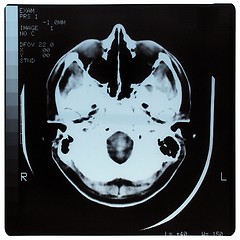 Image showing Medical Xray