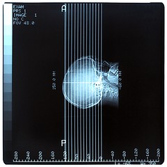 Image showing Medical Xray