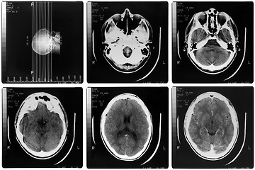 Image showing Medical Xray