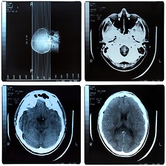 Image showing Medical Xray