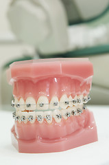 Image showing lower and upper dental jaw braces model