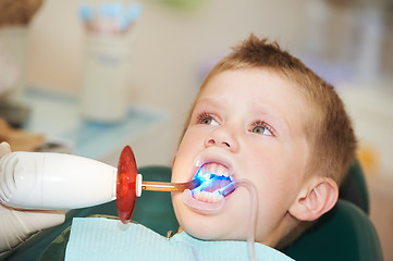 Image showing dental filing of child tooth by ultraviolet light