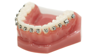 Image showing lower dental jaw bracket braces model isolated