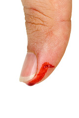 Image showing Bleeding thumb finger
