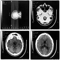 Image showing Medical Xray