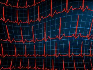 Image showing ECG tracing monitor. EPS 8