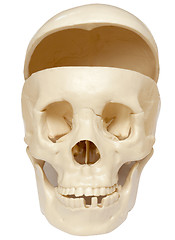 Image showing Open skull