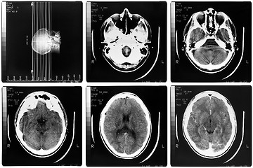 Image showing Medical Xray