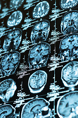 Image showing Ct scan of the human brain tile