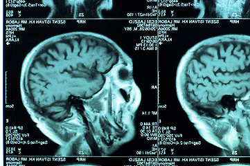 Image showing Ct scan of the human brain tile